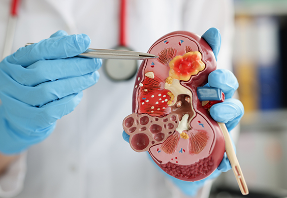 Nephrology Technologies